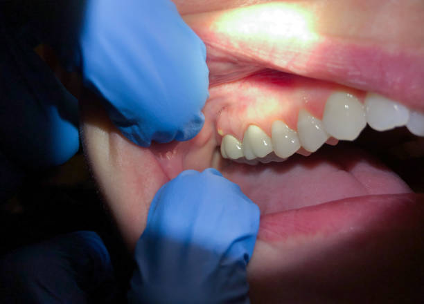 Best Weekend Emergency Dentist in New Paleste, IN