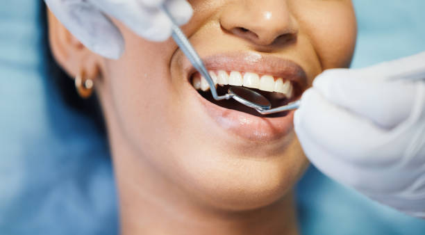 Best Emergency Broken Tooth Repair in New Paleste, IN