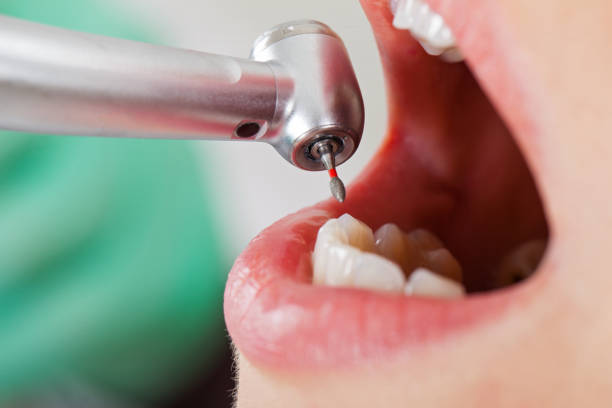 Best Urgent Dental Care in New Paleste, IN